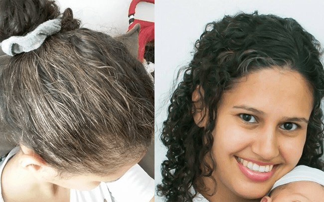 Como disfarçar o cabelo branco? Conheça 6 dicas!