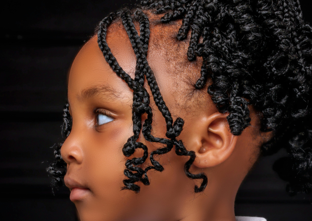 Alopecia por tração em cabelo cacheado infantil