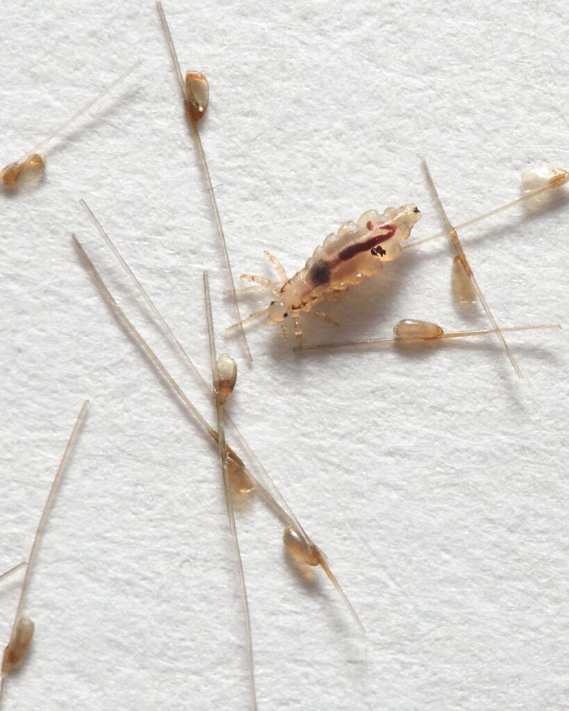 Diferença de piedra branca, caspa e lêndeas 