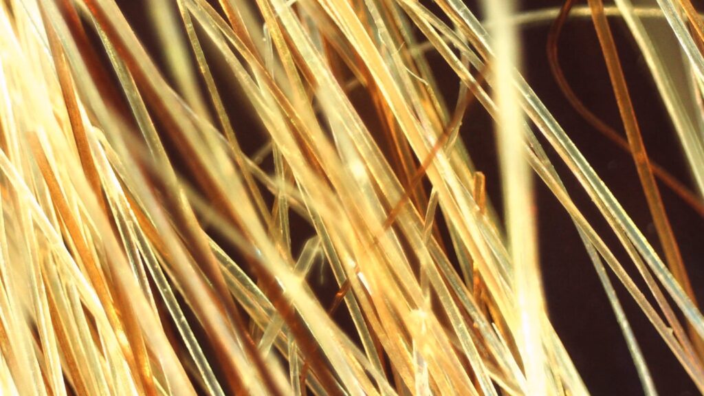 Tricoscopia de tricorrexe nodosa, um sinal de quebra muito comum em cabelos cacheados 